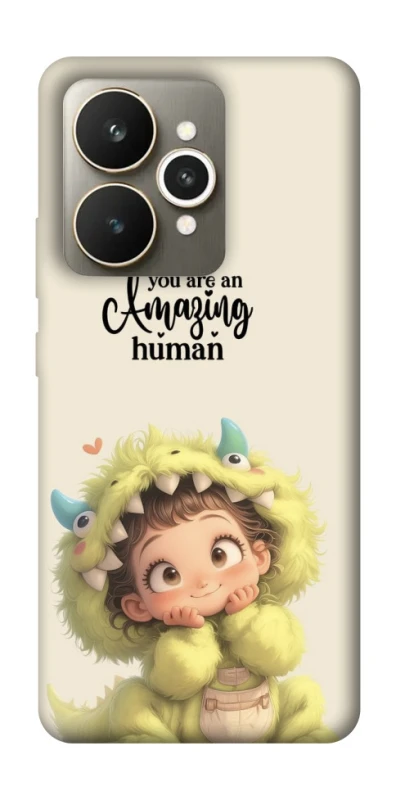 Чохол на Realme 15 You are amazing фото 1 з 1