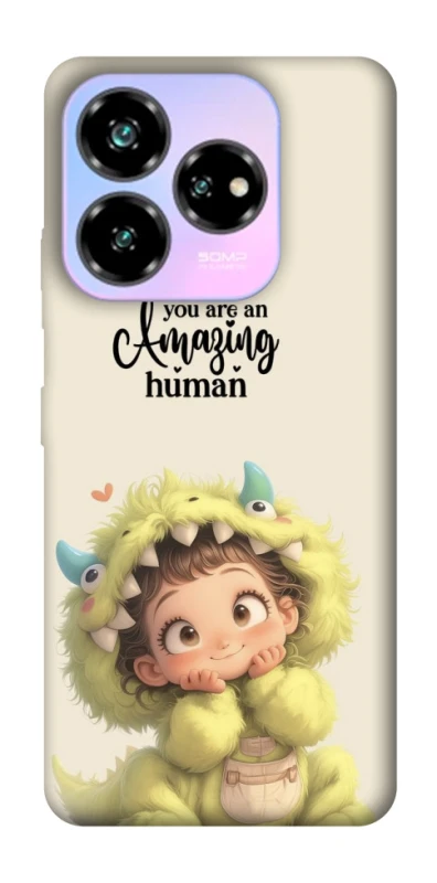 Чохол на ZTE Nubia V60 Desing You are amazing фото 1 з 1