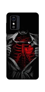Чохол на ZTE Blade L9 Skeleton Heart фото 1 з 1
