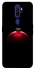 Чохол на Oppo A5 (2020) / Oppo A9 (2020) Christmas bauble фото 1 з 1