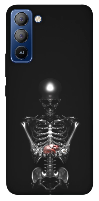 Чохол на TECNO Pop 5 LTE Скелетон фото 1 з 1