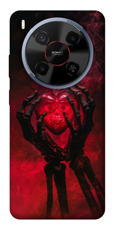 Чохол на ZTE Blade V70 Max Heart in the hands of a skeleton фото 1 з 1