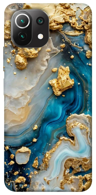 Чохол на Xiaomi Mi 11 Lite Epoxy design ver.2 фото 1 з 1