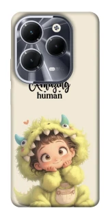 Чехол на Infinix Hot 40 Pro You are amazing фото 1 из 1