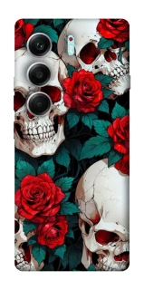 Чохол на Tecno Camon 40 Pro skull and rose фото 1 з 1