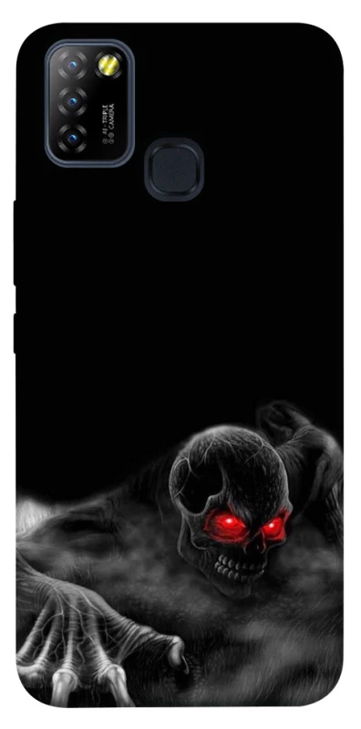 Чехол на Infinix Hot 10 Lite Skeleton v3 фото 1 из 1