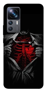 Чехол на Xiaomi 12T / 12T Pro Skeleton Heart фото 1 из 1