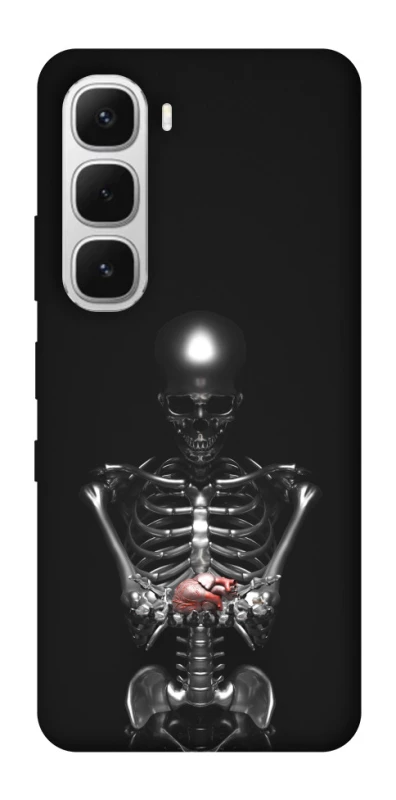 Чохол на Infinix Hot 60i Скелетон фото 1 з 1