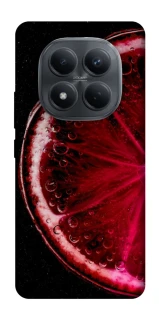 Чохол на Xiaomi Redmi Note 15 Pro 4G Candy фото 1 з 1