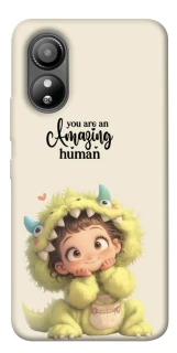 Чехол на ZTE Blade L220 You are amazing фото 1 из 1