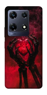 Чехол на Infinix Note 30 Pro Heart in the hands of a skeleton фото 1 из 1