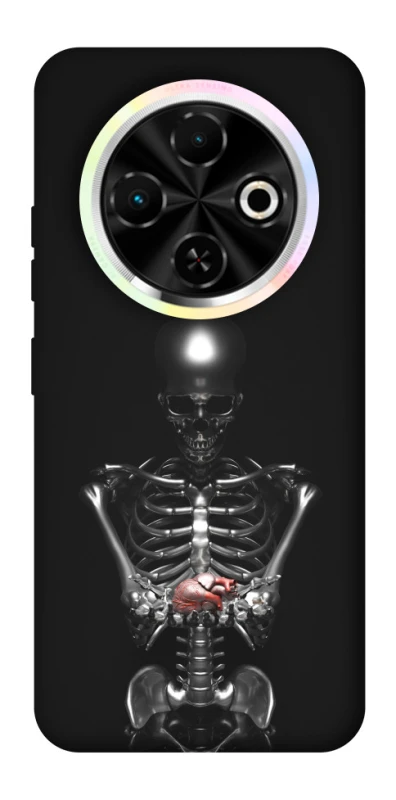 Чохол на TECNO Spark 30C Скелетон фото 1 з 1