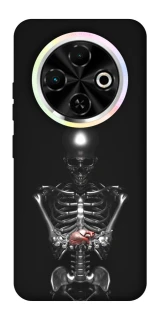 Чохол на TECNO Spark 30C Скелетон фото 1 з 1