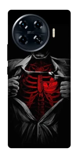 Чохол на TECNO Spark 20 Pro+ Skeleton Heart фото 1 з 1
