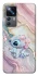 Чехол на Xiaomi 12T / 12T Pro Stitch ver.26 фото 1 из 1