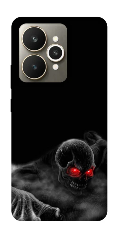 Чохол на Realme 15 Skeleton v3 фото 1 з 1