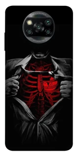 Чехол на Xiaomi Poco X3 NFC / Poco X3 Pro Skeleton Heart фото 1 из 1