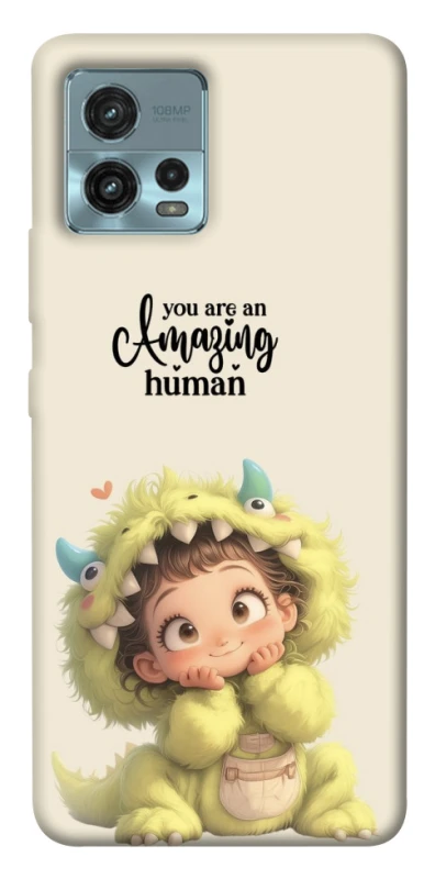 Чохол на Motorola Moto G72 You are amazing фото 1 з 1