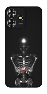 Чехол на ZTE Blade A73 4G Скелетон фото 1 из 1