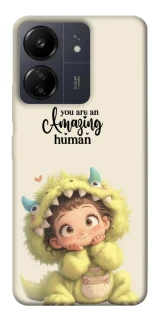 Чехол на Xiaomi Redmi 13C You are amazing фото 1 из 1