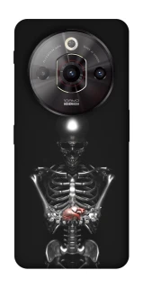 Чохол на ZTE Nubia Focus Pro Скелетон фото 1 з 1