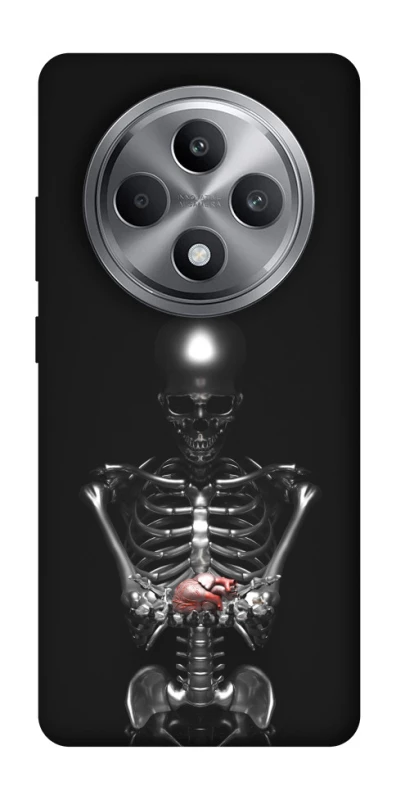 Чохол на Oppo Reno 12 F 4G Скелетон фото 1 з 1