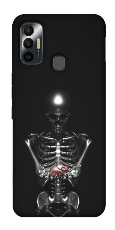 Чохол на TECNO Spark 7 Скелетон фото 1 з 1