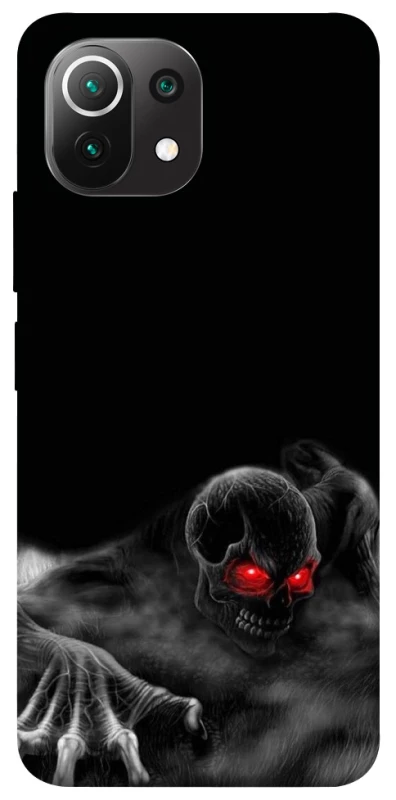 Чохол на Xiaomi Mi 11 Lite Skeleton v3 фото 1 з 1