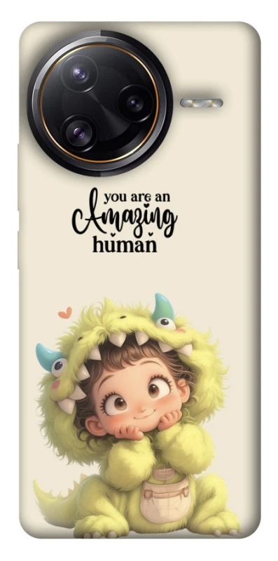 Чохол на Xiaomi Poco F7 Ultra You are amazing фото 1 з 1