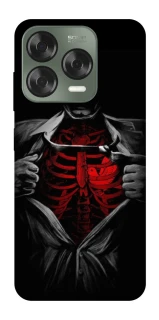 Чохол на ZTE Nubia V70 Design Skeleton Heart фото 1 з 1