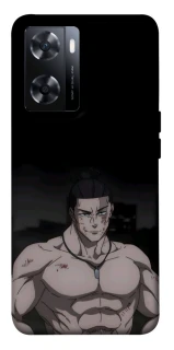 Чохол на OnePlus Nord N20 SE Todo фото 1 з 1