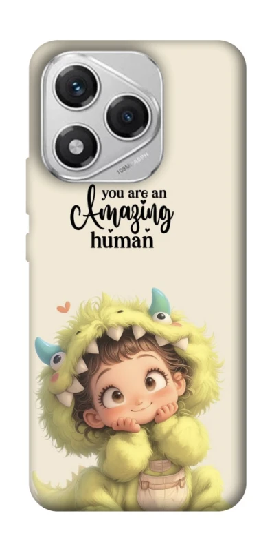 Чохол на Honor 400 Lite You are amazing фото 1 з 1