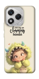 Чохол на Honor 400 Lite You are amazing фото 1 з 1