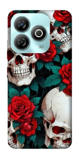 Чохол на ZTE Blade A75 4G skull and rose фото 1 з 1