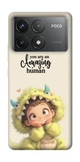 Чохол на Xiaomi Poco F6 Pro You are amazing фото 1 з 1