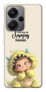 Чехол на Xiaomi Redmi Note 13 Pro+ You are amazing фото 1 из 1