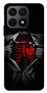 Чохол на Huawei Honor X8a Skeleton Heart фото 1 з 1