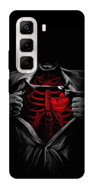 Чохол на Infinix Hot 50 4G Skeleton Heart фото 1 з 1