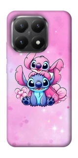 Чехол на Xiaomi 15T Stitch ver.11 фото 1 из 1