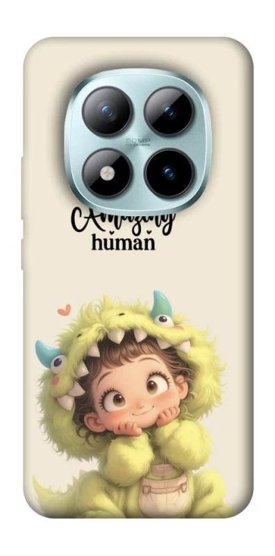 Чохол на Xiaomi Redmi Note 15 Pro+ 5G You are amazing фото 1 з 1