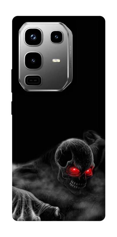 Чохол на Infinix Note 50 Pro Skeleton v3 фото 1 з 1