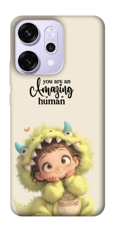 Чехол на Oppo Reno 14 Pro You are amazing фото 1 из 1