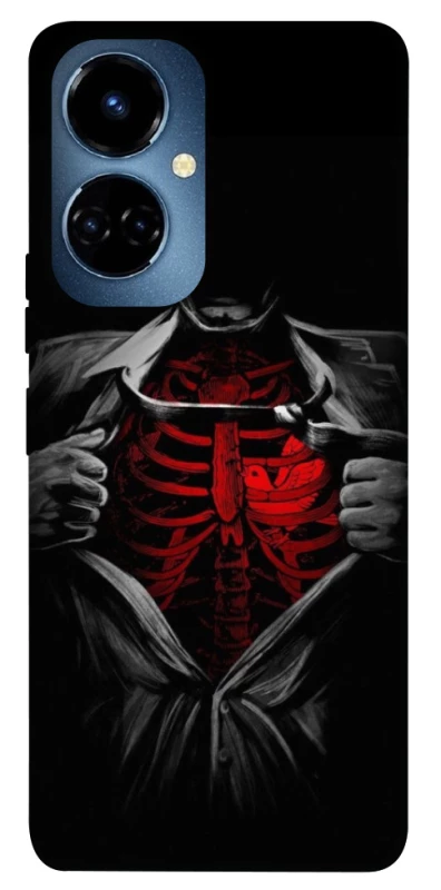 Чехол на TECNO Camon 19 Skeleton Heart фото 1 из 1