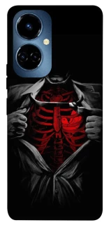 Чохол на TECNO Camon 19 Skeleton Heart фото 1 з 1