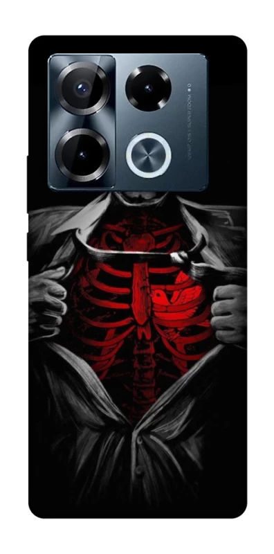 Чохол на Infinix Note 40 Pro 4G Skeleton Heart фото 1 з 1