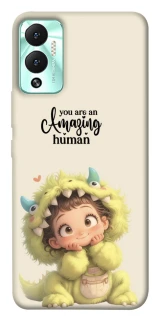 Чохол на Infinix Hot 12 Play You are amazing фото 1 з 1
