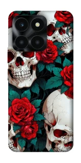 Чохол на Huawei Honor X6a skull and rose фото 1 з 1