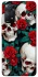 Чохол на Xiaomi Redmi Note 11 Pro 4G/5G skull and rose фото 1 з 1