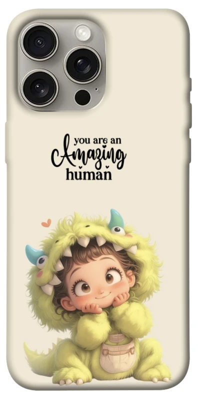 Чохол You are amazing фото 1 з 1