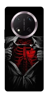 Чехол на Honor X9c Skeleton Heart фото 1 из 1